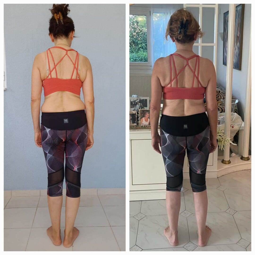 "Relief from chronic lower back and hip pain after 15 years, thanks to strengthening and correcting posture using the Functional Patterns method."